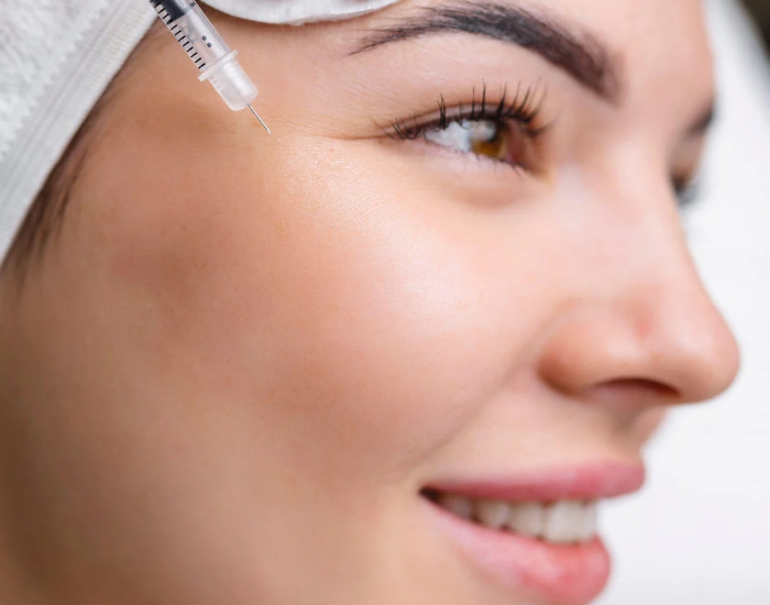 Top 5 Reasons to Consider Botox Before 35