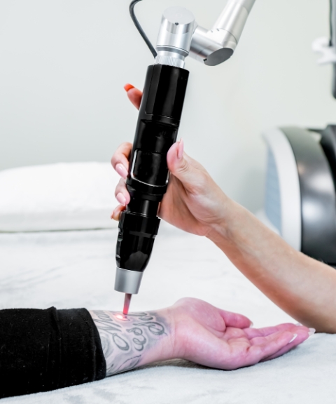 Medical spa tattoo removal services Stafford TX