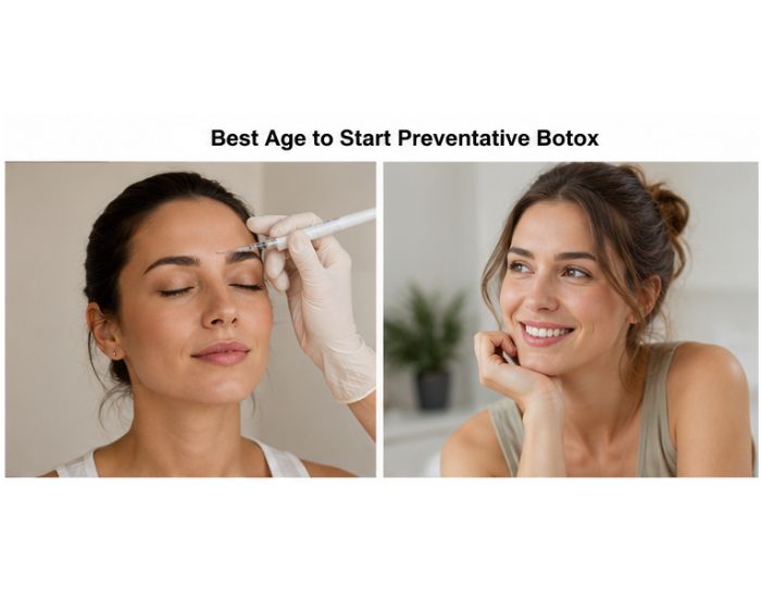 Best Age to Start Preventative Botox